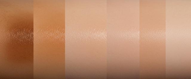How to Fade Post-Inflammatory Hyperpigmentation: Tips and Treatments